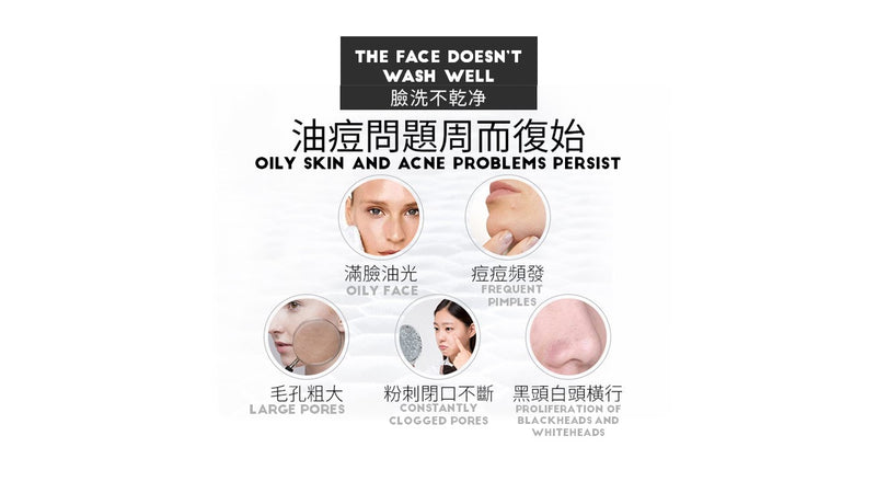 淨痘清顏潔面乳 (80g) [敏感肌膚適用]